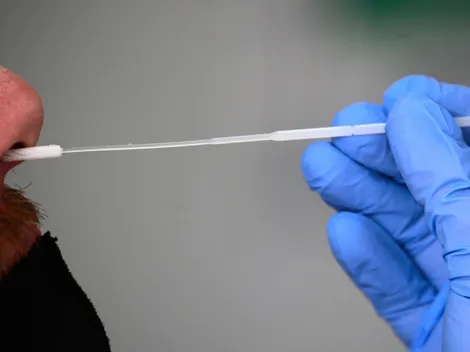 ¿En qué farmacias puedo comprar el autotest de antígeno de Covid-19?