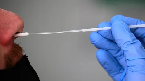 ¿En qué farmacias puedo comprar el autotest de antígeno de Covid-19?