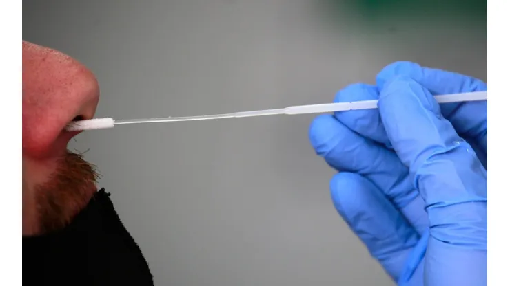 ¿En qué farmacias puedo comprar el autotest de antígeno de Covid-19?