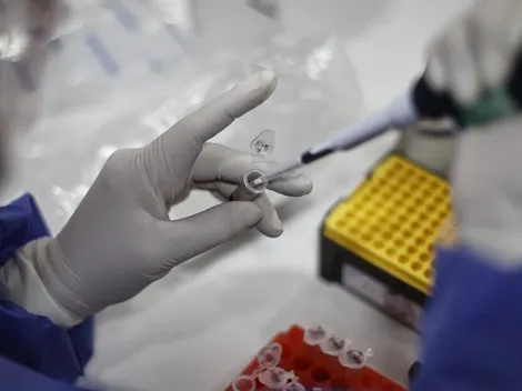 ¿Cuáles son los síntomas más comunes de la Viruela del Mono?