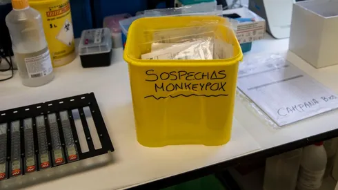 ¿Cómo se contagia y qué es la Viruela del Mono?