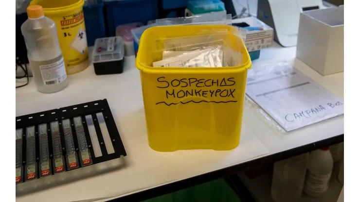 ¿Cómo se contagia y qué es la Viruela del Mono?