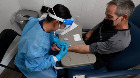 ¿Cuáles son los síntomas de la viruela del mono y a quiénes se vacunará?