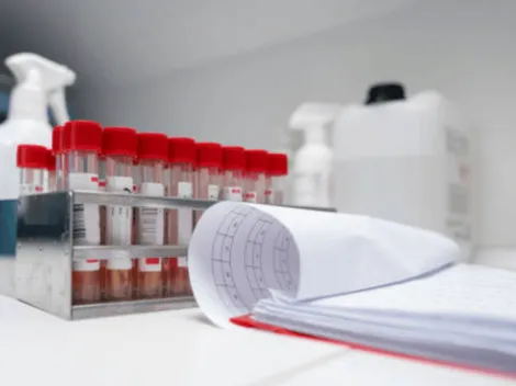 ¿Cómo se contagia y qué aumenta el riesgo de contraer la viruela del mono?