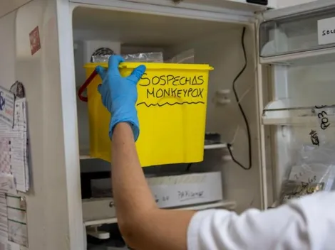 OMS prevé que se puede eliminar la Viruela del mono en Europa