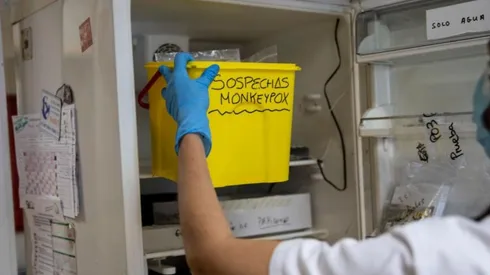 OMS prevé que se puede eliminar la Viruela del mono en Europa