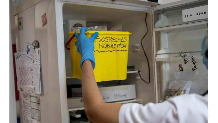 OMS prevé que se puede eliminar la Viruela del mono en Europa