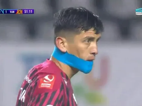 Extravagante vendaje se lleva las miradas en triunfo de Rangers