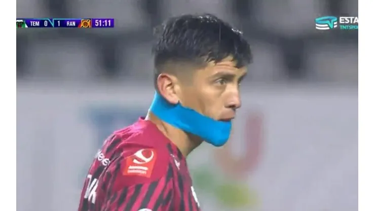 El insólito vendaje de Iturra en Rangers