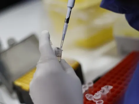 ¿Cómo se transmite la viruela del mono y cómo cuidarme para no contagiarme?