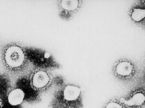 ¿Qué es la gripe del tomate?