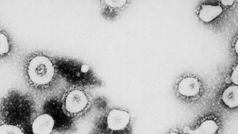 ¿Qué es la gripe del tomate?