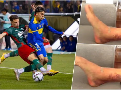 Espeluznante: Revelan cómo está el tobillo del juvenil de Boca