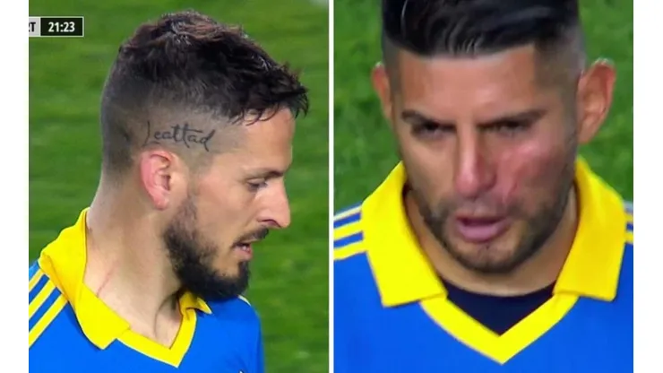Bendetto con un rasguño y Zambrano con la cara golpeada