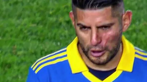 Carlos Zambrano llegó golpeado desde los camarines