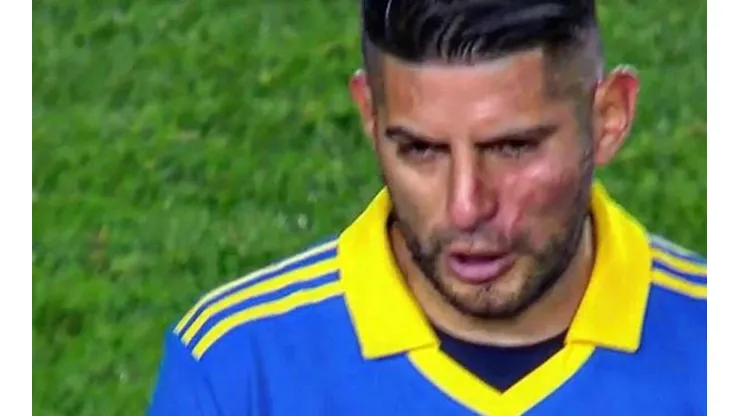Carlos Zambrano llegó golpeado desde los camarines