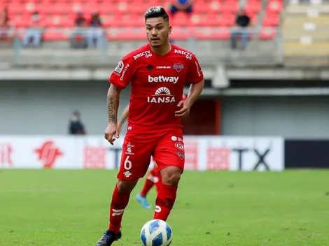 "El Ceniza": Ñublense es pura risa con el nuevo look de Lolo Reyes