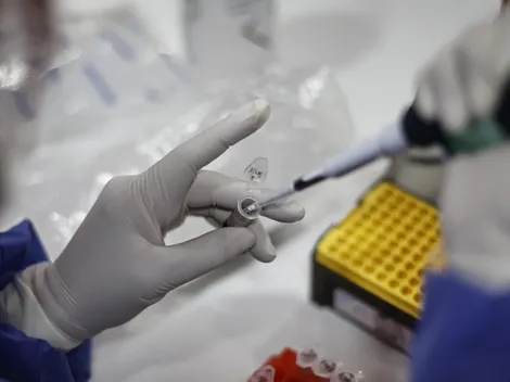 Colmed por viruela del mono: "Estamos a tiempo de contener los casos"