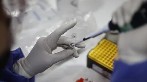 Colmed por viruela del mono: "Estamos a tiempo de contener los casos"