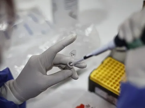 ¿La viruela del mono es considerada una enfermedad de transmisión sexual?