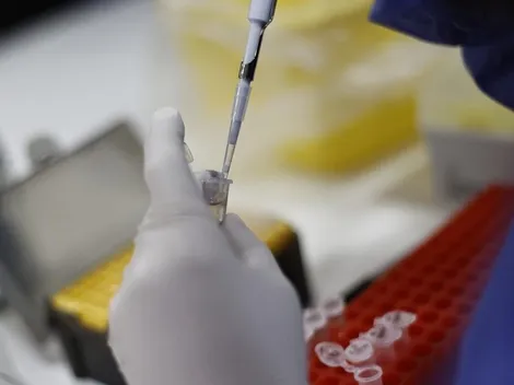 ¿Cómo se transmite la viruela del mono?