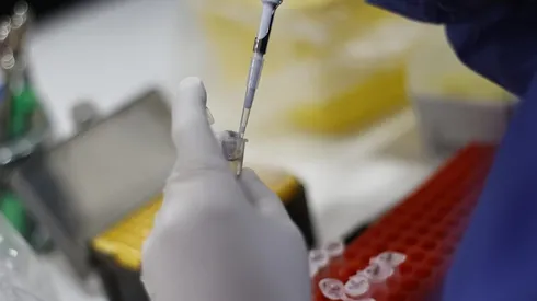 ¿Cómo se transmite la viruela del mono?