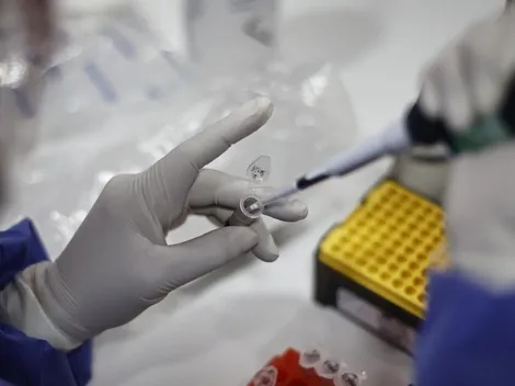 Casos de Viruela del Mono aumentan 95% en una semana en Chile