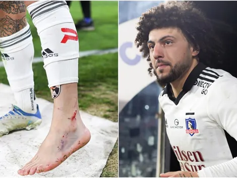 Así le queda el tobillo a Falcón y avisa cómo está para el Superclásico