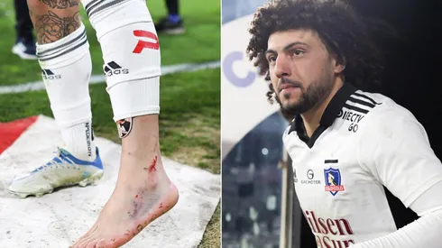 El tobillo a maltraer de Maxi Falcón. No obstante, dice que llega al Superclásico.