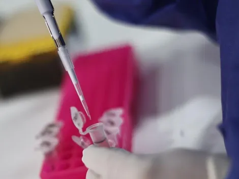 ¿Será considerada la Viruela del Mono como pandemia por la OMS?