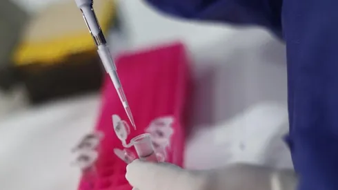 ¿Será considerada la Viruela del Mono como pandemia por la OMS?