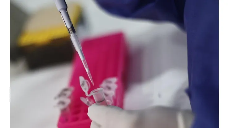 ¿Será considerada la Viruela del Mono como pandemia por la OMS?