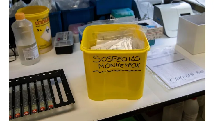 ¿Cómo se contagia la Viruela del Mono?
