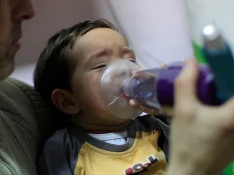 ¿Cuáles son los síntomas más comunes del virus sincicial?