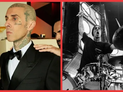 Travis Barker está hospitalizado grave