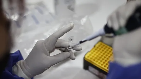 ¿Cuáles son los síntomas de la viruela del mono y qué es la alerta sanitaria?