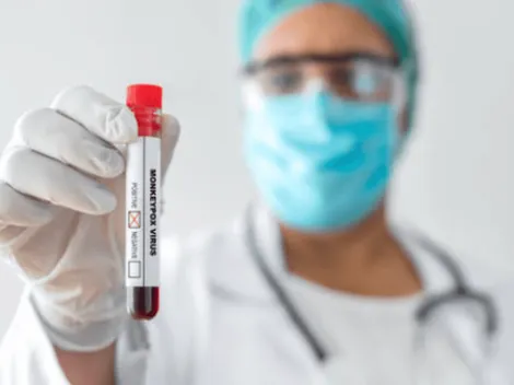 ¿Cómo prevenir contagiarse de la viruela del mono?