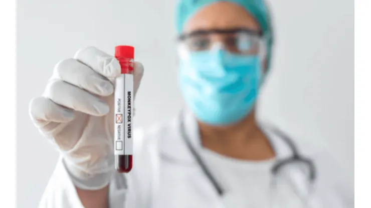 ¿Cómo prevenir la viruela del mono?