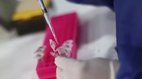 El Minsal anunció un nuevo caso de Viruela del Mono.