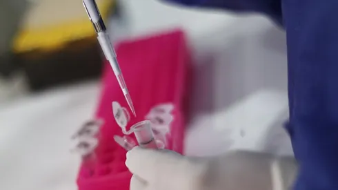 ¿Qué es la zoonosis y cómo se relaciona con la viruela del mono?