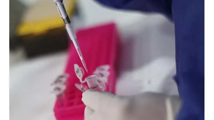 ¿Qué es la zoonosis y cómo se relaciona con la viruela del mono?