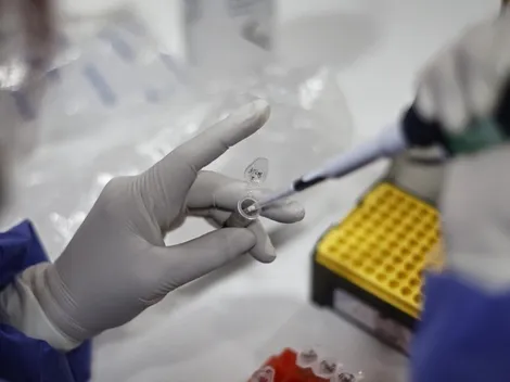 Viruela del Mono | Conoce su método de contagio y síntomas