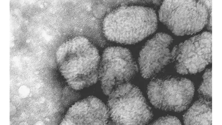 Imagen Microscópica de viruela del mono