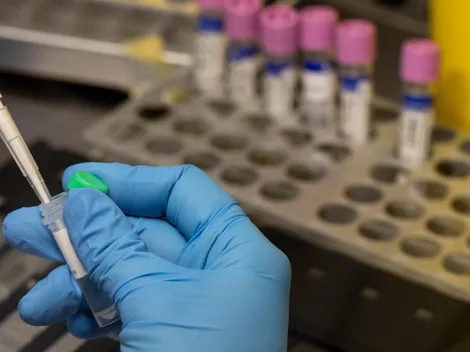 ¿La viruela del mono podría convertirse en una pandemia?