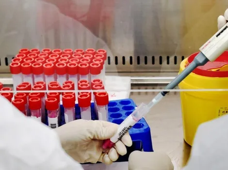 Covid-19 | Revisa aquí los síntomas del Coronavirus