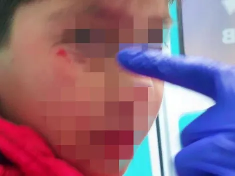 Madre del niño alcanzado por bengala pide justicia