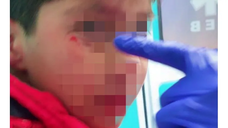 La madre de Thiago pidió justicia tras ser alcanzado por una bengala.
