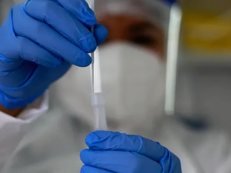 ¿Cuántos casos de Covid-19 hay este lunes 11 de abril?