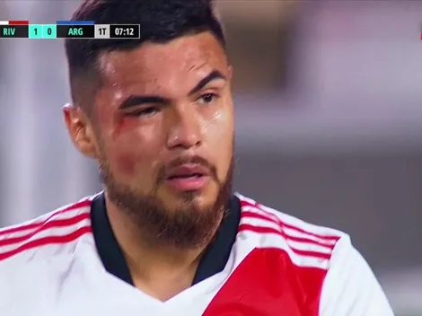 Paulo Díaz sufre tremendo choque peleando una pelota