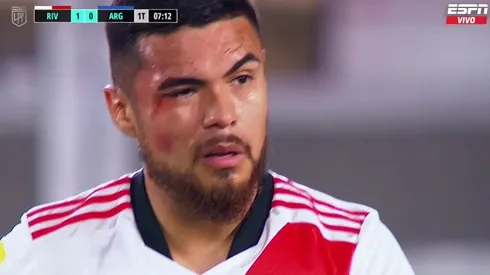 Paulo Díaz quedó con evidentes marcas del encontronazo con Gabriel Ávalos.